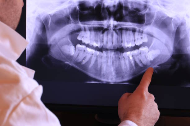 Best Emergency Tooth Extraction in Mcfarland, WI