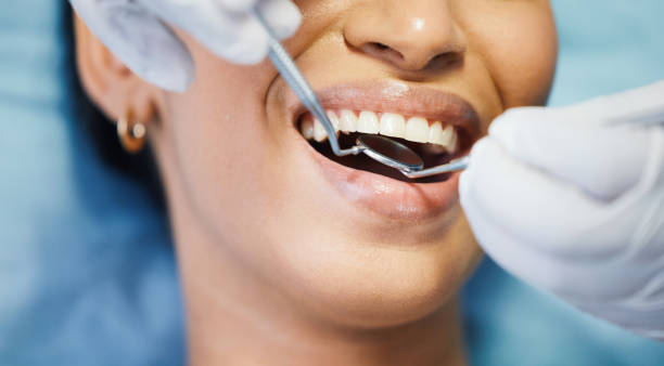 Best Emergency Dental Care for Broken or Chipped Teeth in Mcfarland, WI