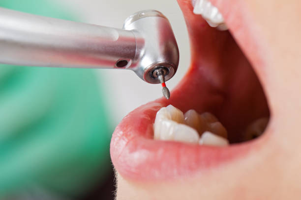 Best Emergency Dental Care for Broken or Chipped Teeth in Mcfarland, WI